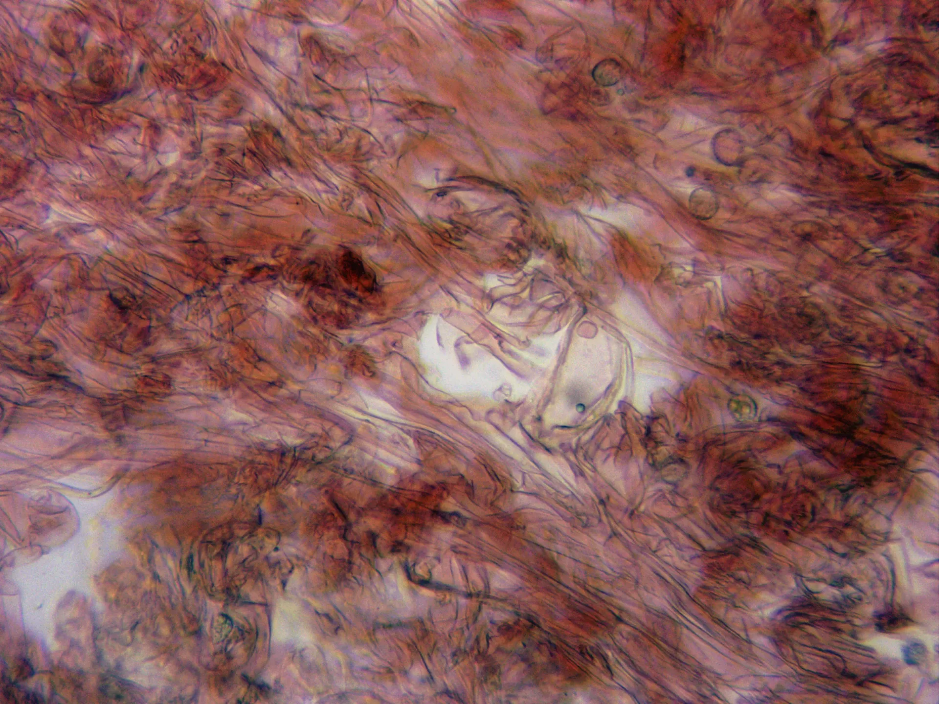 Microscopía de Laccaria proxima - 5 - Pileipellis x 400
